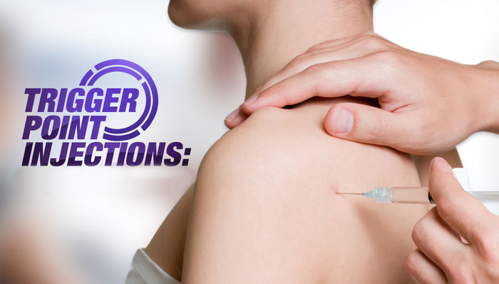 Painful Knotted Muscles? Trigger Point Injections Might Help